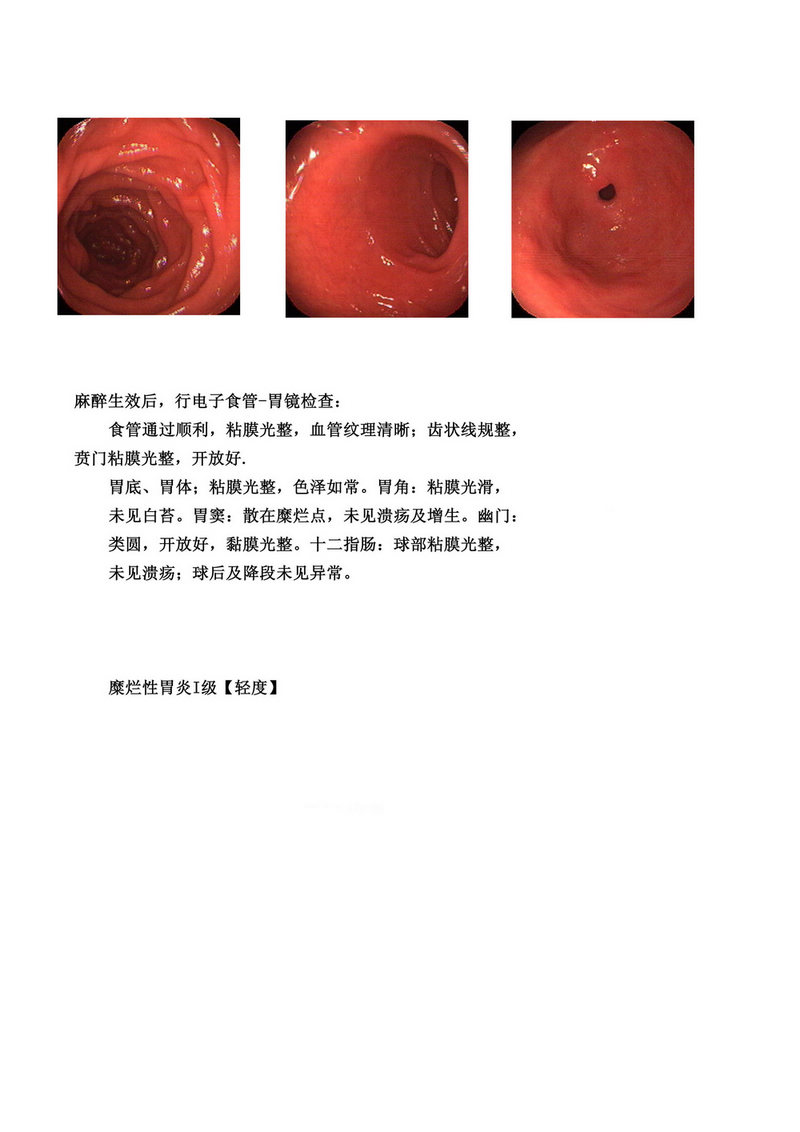 B超胶片， 彩色激光胶片