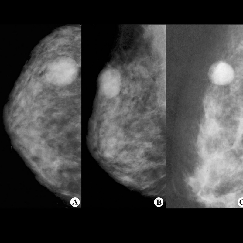 希龙牌，医用CT/DR等胶片 MPET